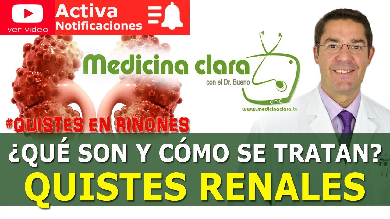 Quistes renales ó Quistes en el riñón ¿es grave? |  Medicina Clara Dr. Bueno