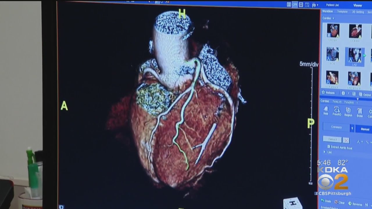 Coronavirus Can Have Lasting Effects On Heart, Lungs New Research Says