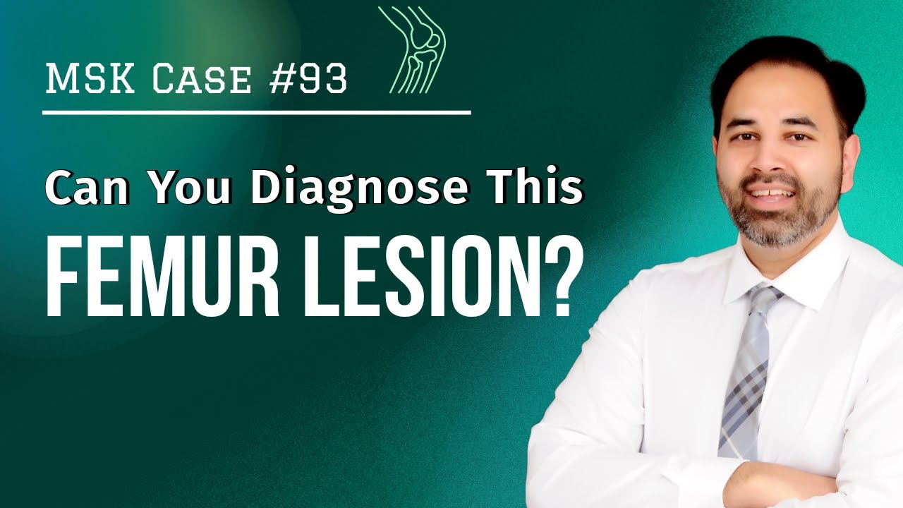 MSK #93 - Can You Diagnose This Femur Lesion?