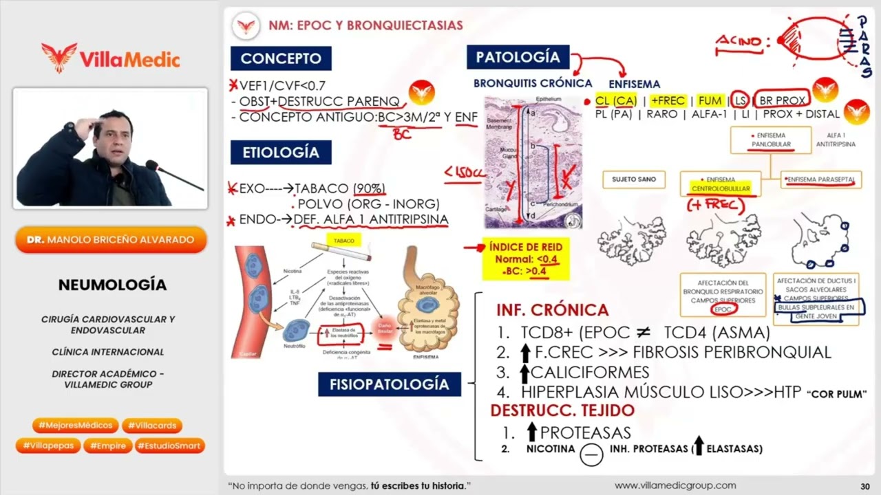 EPOC Y Bronquiectasias VILLAMEDIC