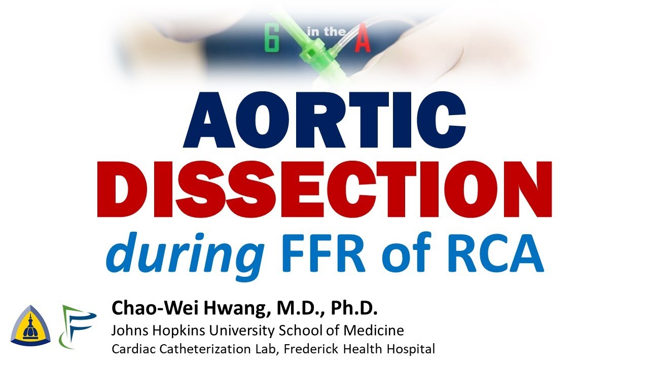 Aortic Dissection during FFR