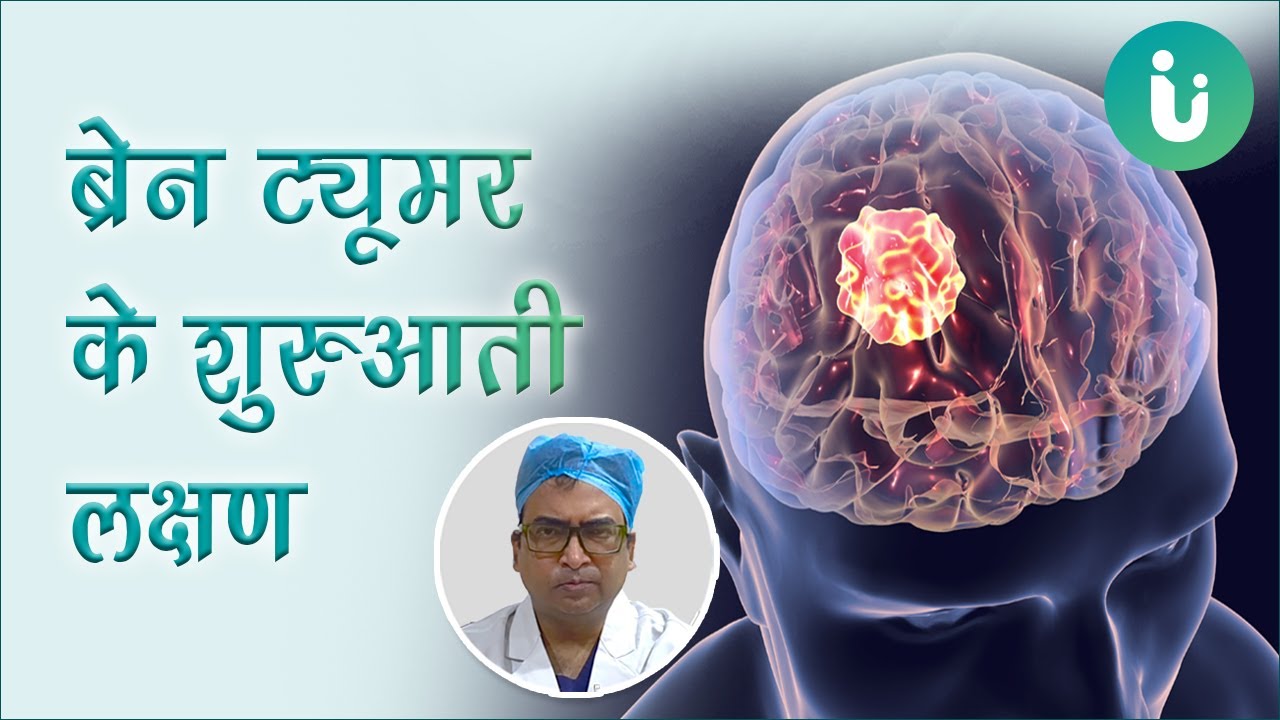 These are the symptoms seen in the beginning of brain tumor. Early symptoms of brain tumor by Dr Praveen Gupta