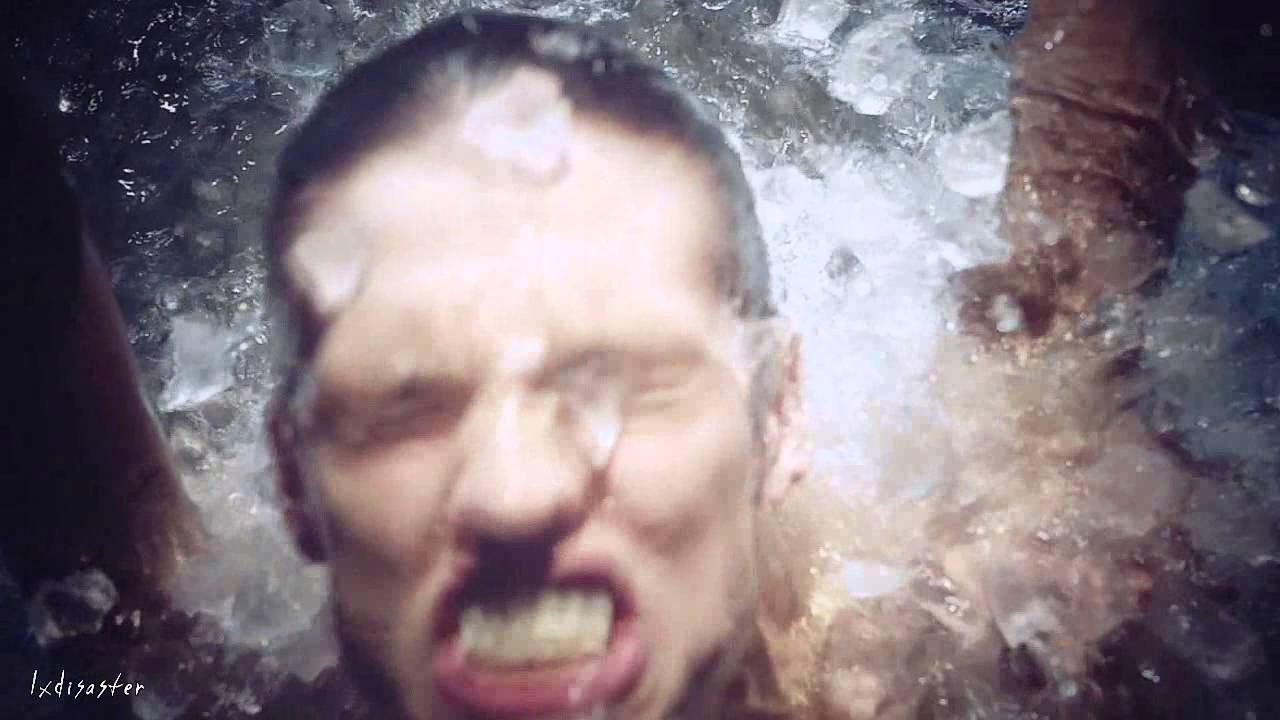 ►Teen Wolf [Razorface]