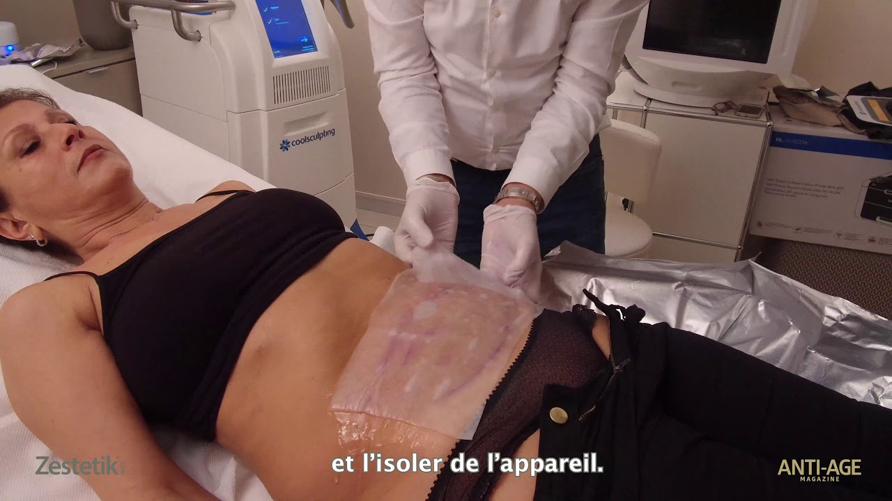 Interview démo - Clinic Vendôme : Méthode de coolsculpting, la cryolipolyse
