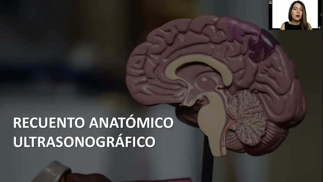 ECOGRAFIA DE LA FOSA POSTERIOR FETAL