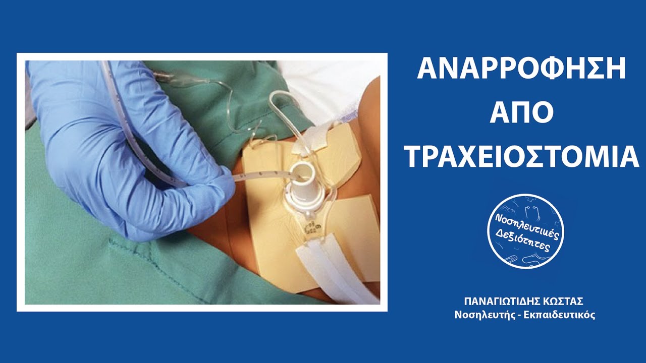 Αναρρόφηση από τραχειοστομία