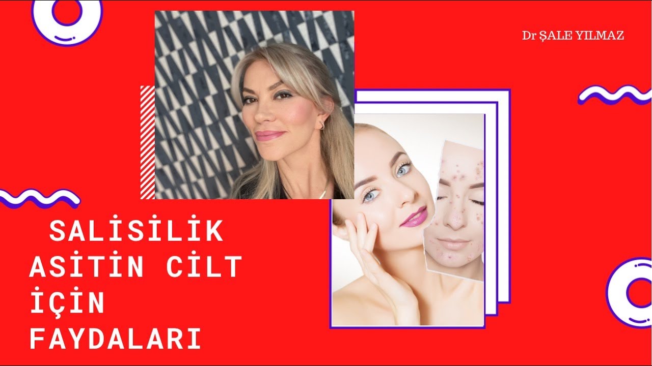 SALİSİLİK ASİT SİVİLCELERE KALICI ÇÖZÜM MÜ? (SALİSİLİK ASİTİN CİLT İÇİN FAYDALARI) Dr ŞALE YILMAZ