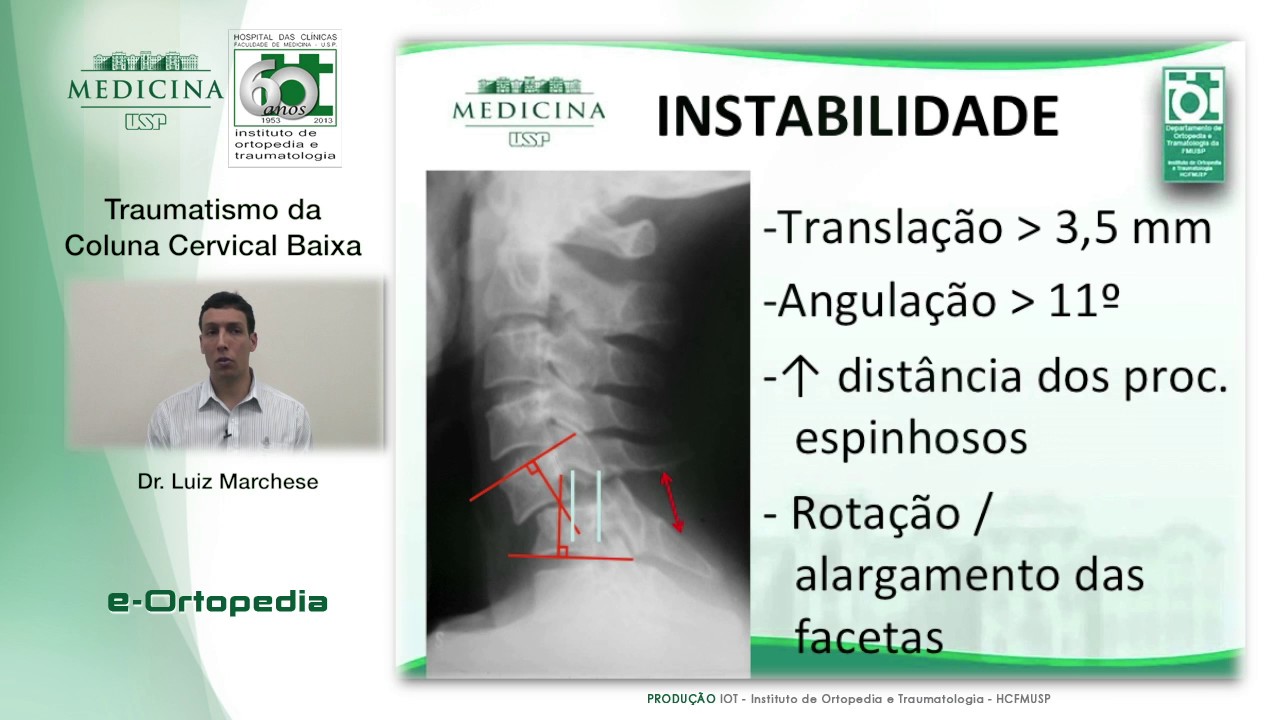 Traumatismo da Coluna Cervical Baixa - Dr. Luiz Marchese