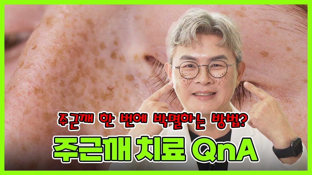 여름 지나고 주근깨밭 된 내 피부! 주근깨 단 한 번에 박멸하는 방법은? 주근깨제거, 주근꺠없애는방법, 주근깨루비레이저