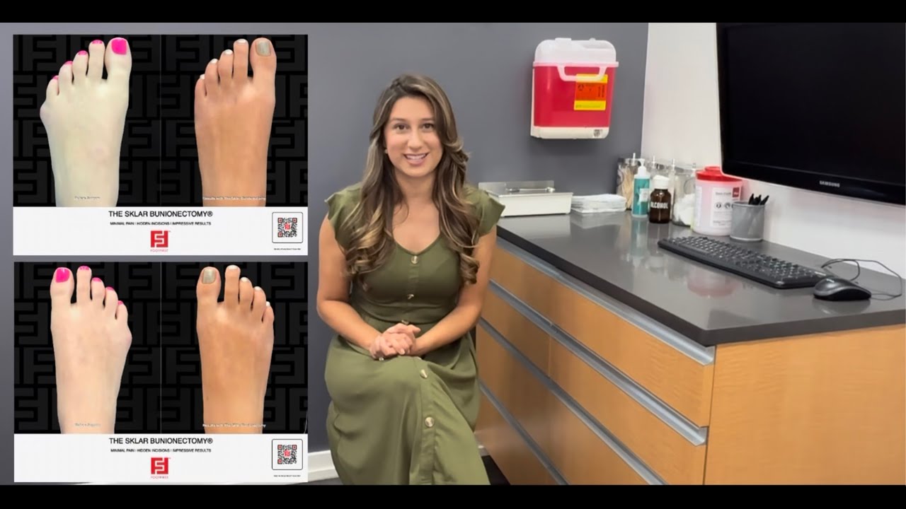 Embarrassed by That Pinky Toe Bump? 👉 Tailor’s Bunion Surgery Explained 👣 #bunions #cosmetics #toes
