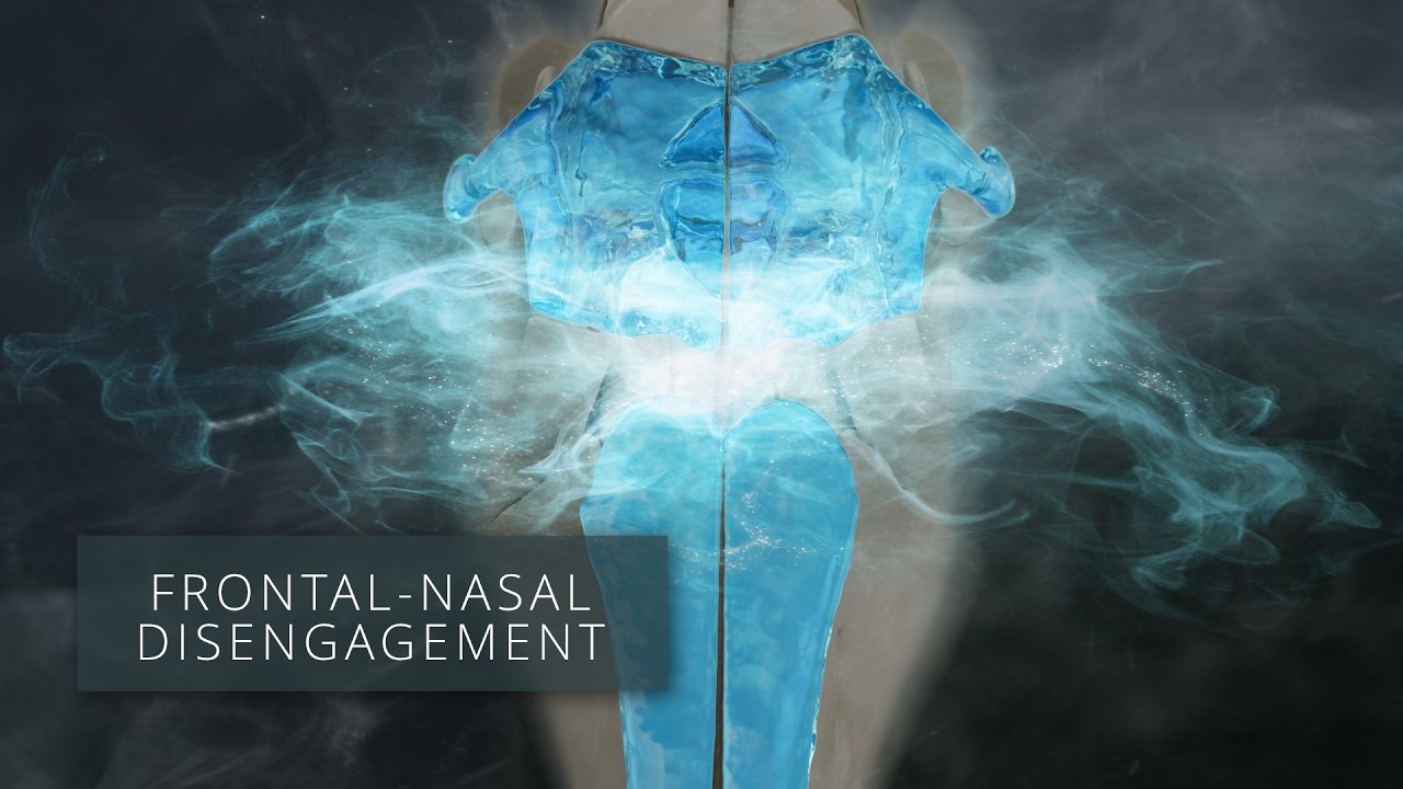 Equine Craniosacral - Frontal - Nasal Disengagement