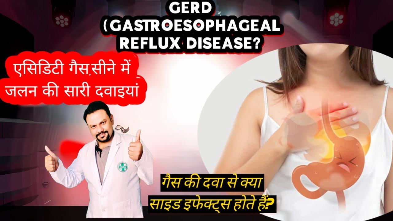 What is GERD? ACIDITY AND HEARTBURN MEDICINE.