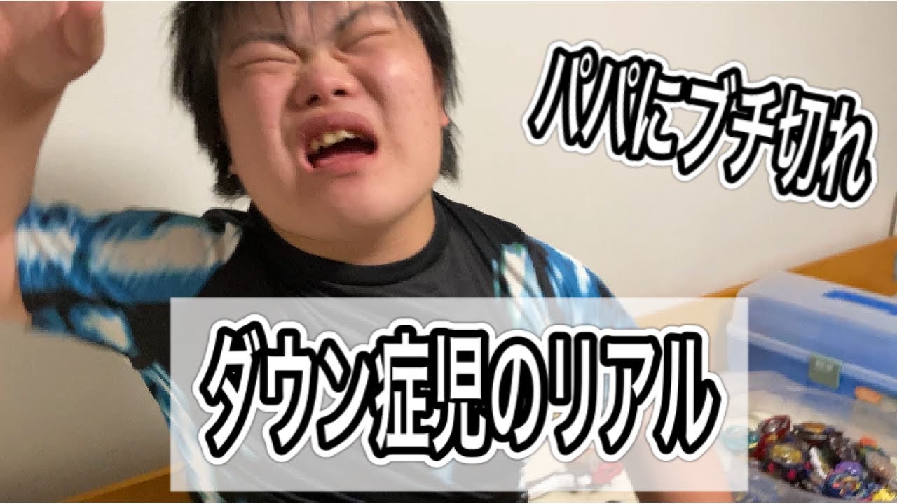 これがダウン症児ミナトのリアルだ！パパにぶち切れ！ミナトTV　おもしろ系ダウン症YouTuber