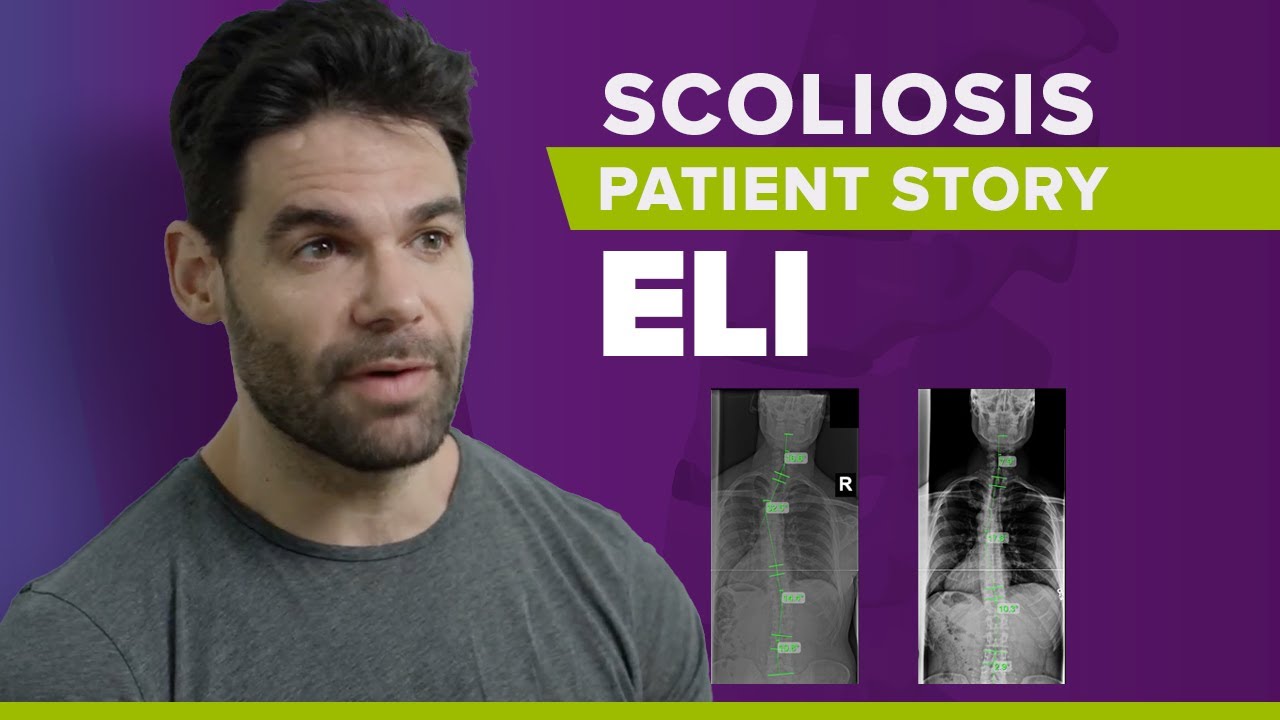 Adult Scoliosis Treatment Without Surgery: Eli's Story