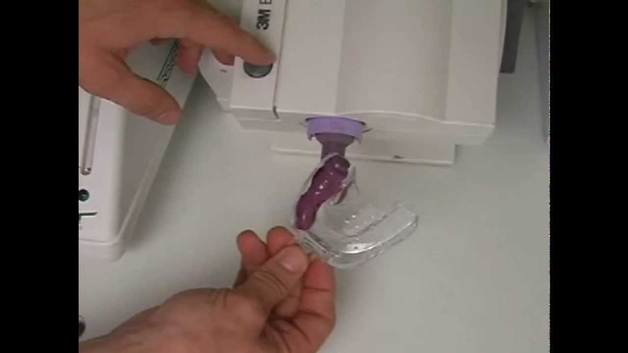 Impregum - Materiale per modellatura dentale