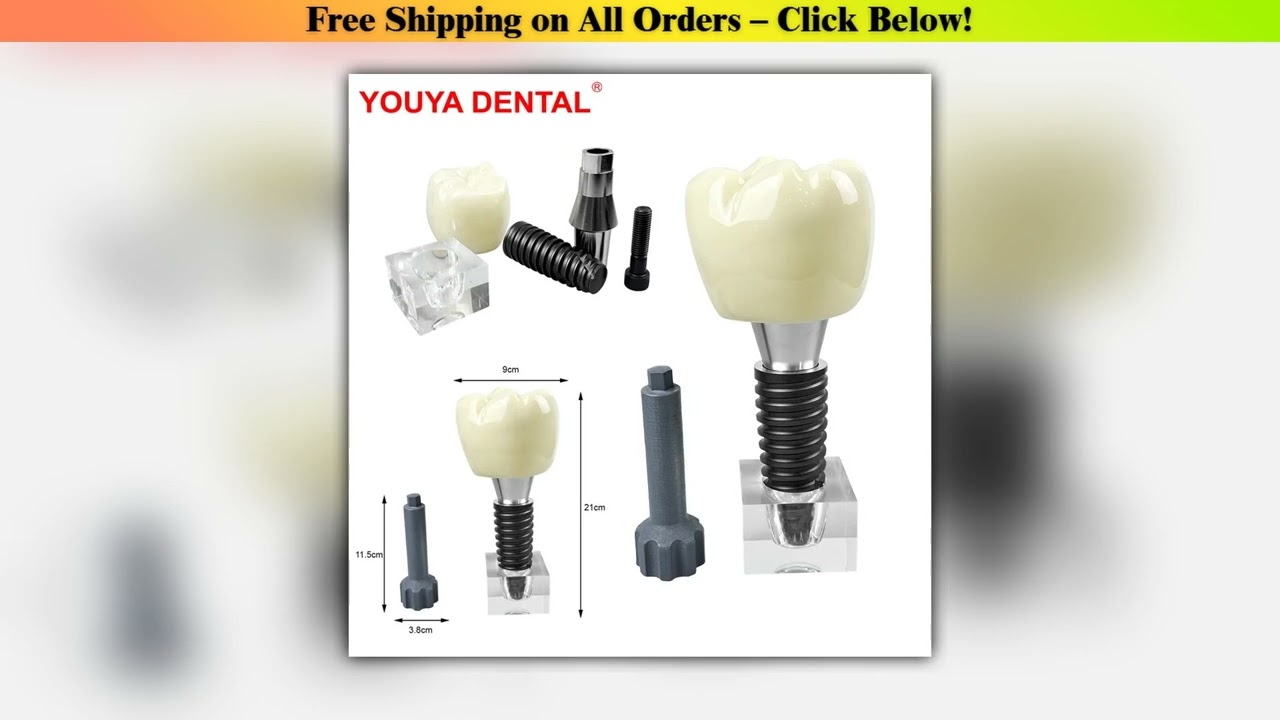 Large Single Dental Implant Model Demonstration Dentistry Detachable Crystal Implant Teeth Model