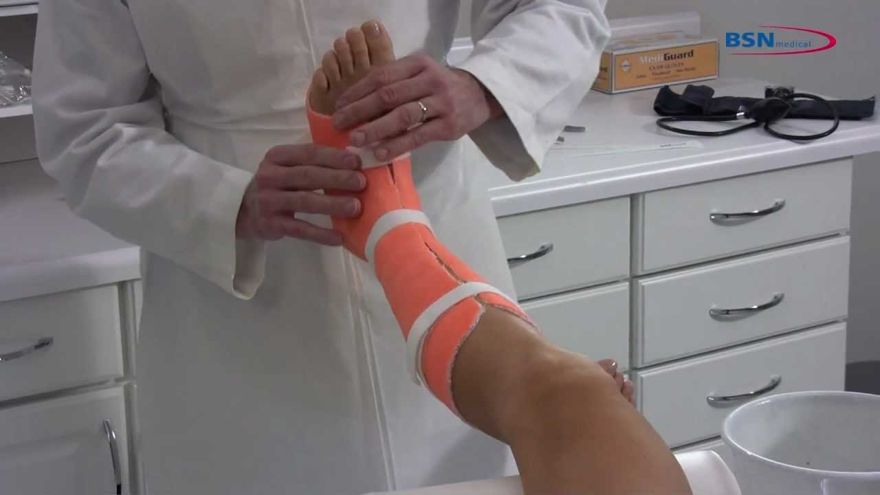 Применение синтетического литого съемного голени_EN_от BSN medical.mov