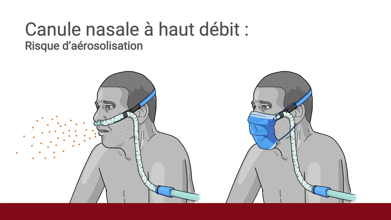 8 Traitement du patient souffrant de dyspn&eacute;e mod&eacute;r&eacute;e- Partie 2