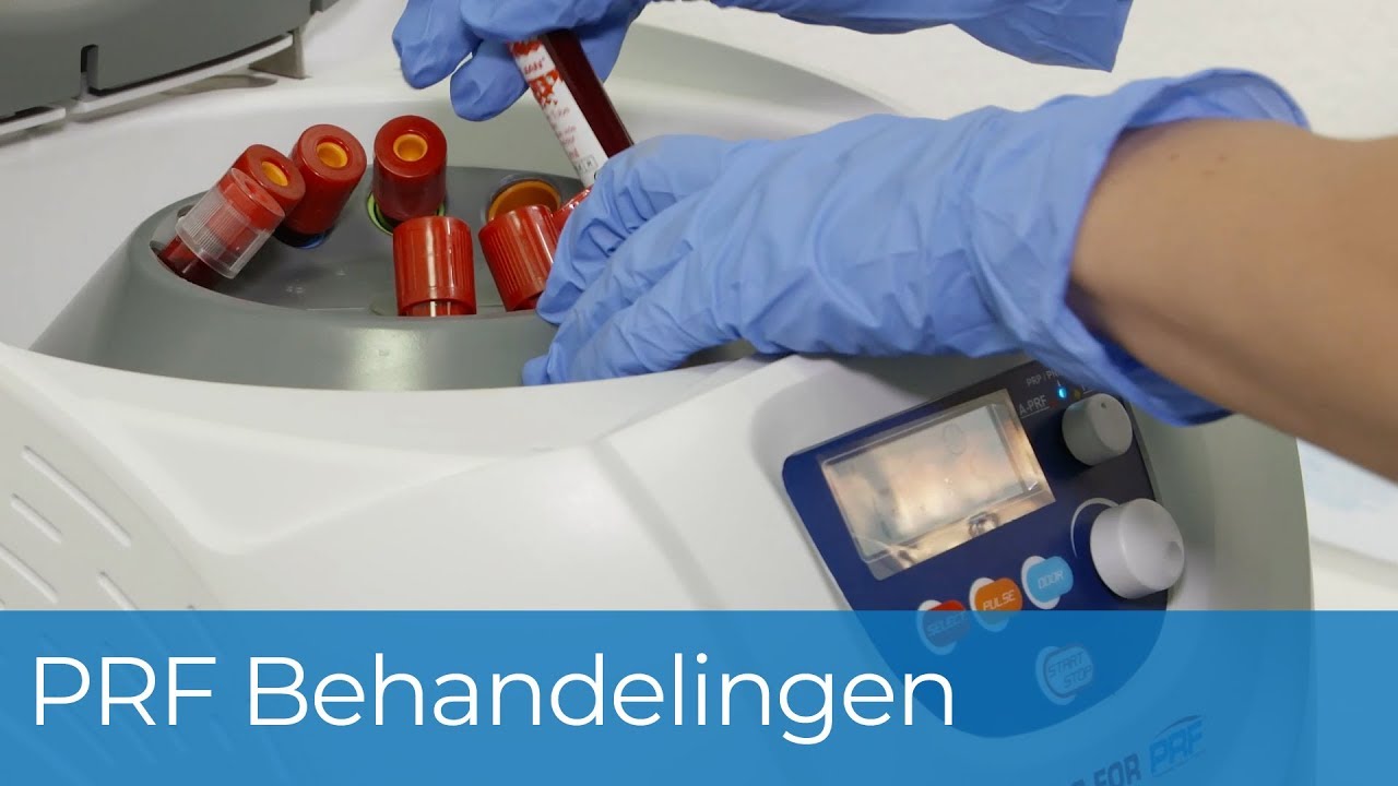 PRF behandelingen