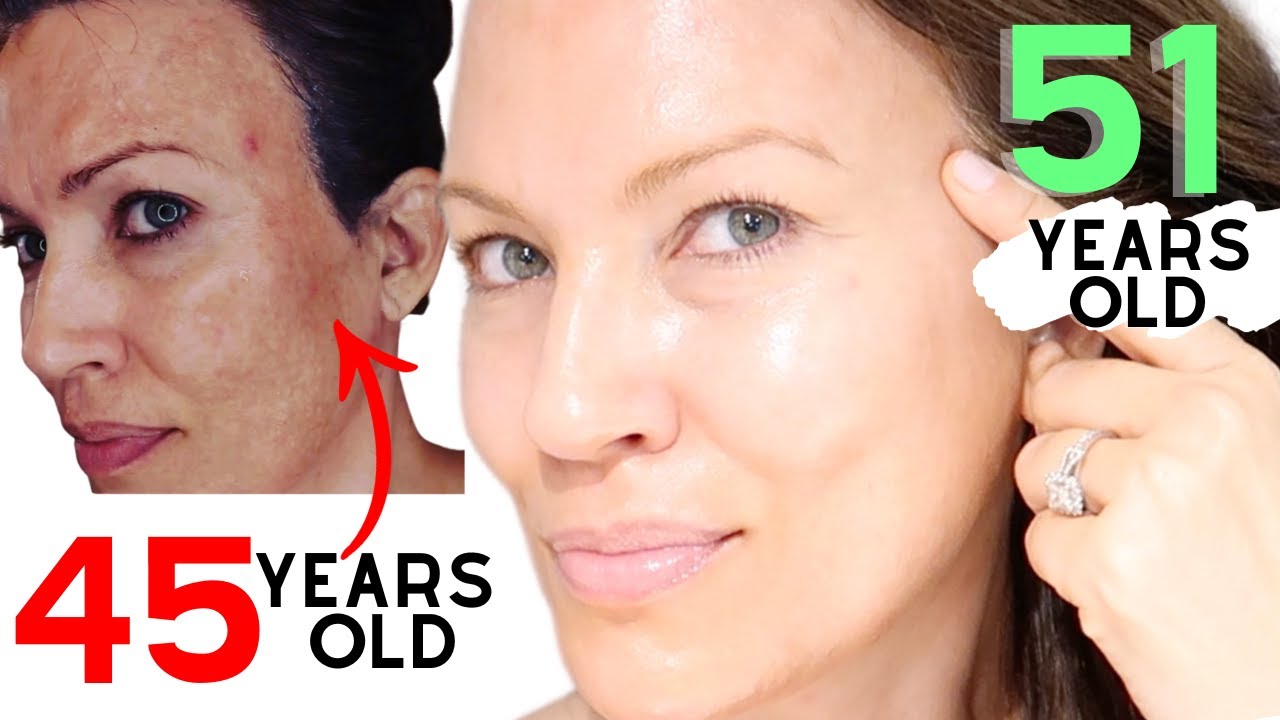 THIS TRANSFORMED MY SKIN!!!