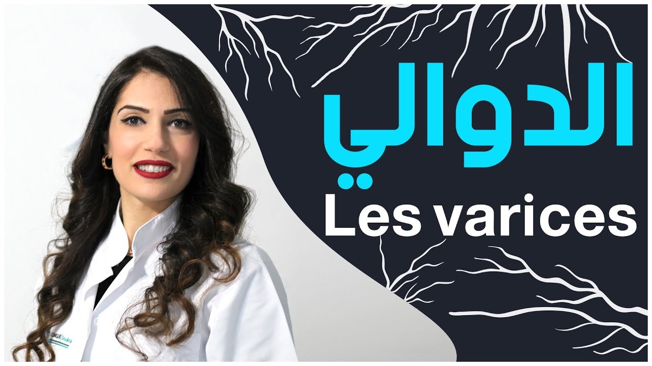 الدوالي في الأطراف السفلية | مع الدكتورة ريم بطاح بن يدّر
