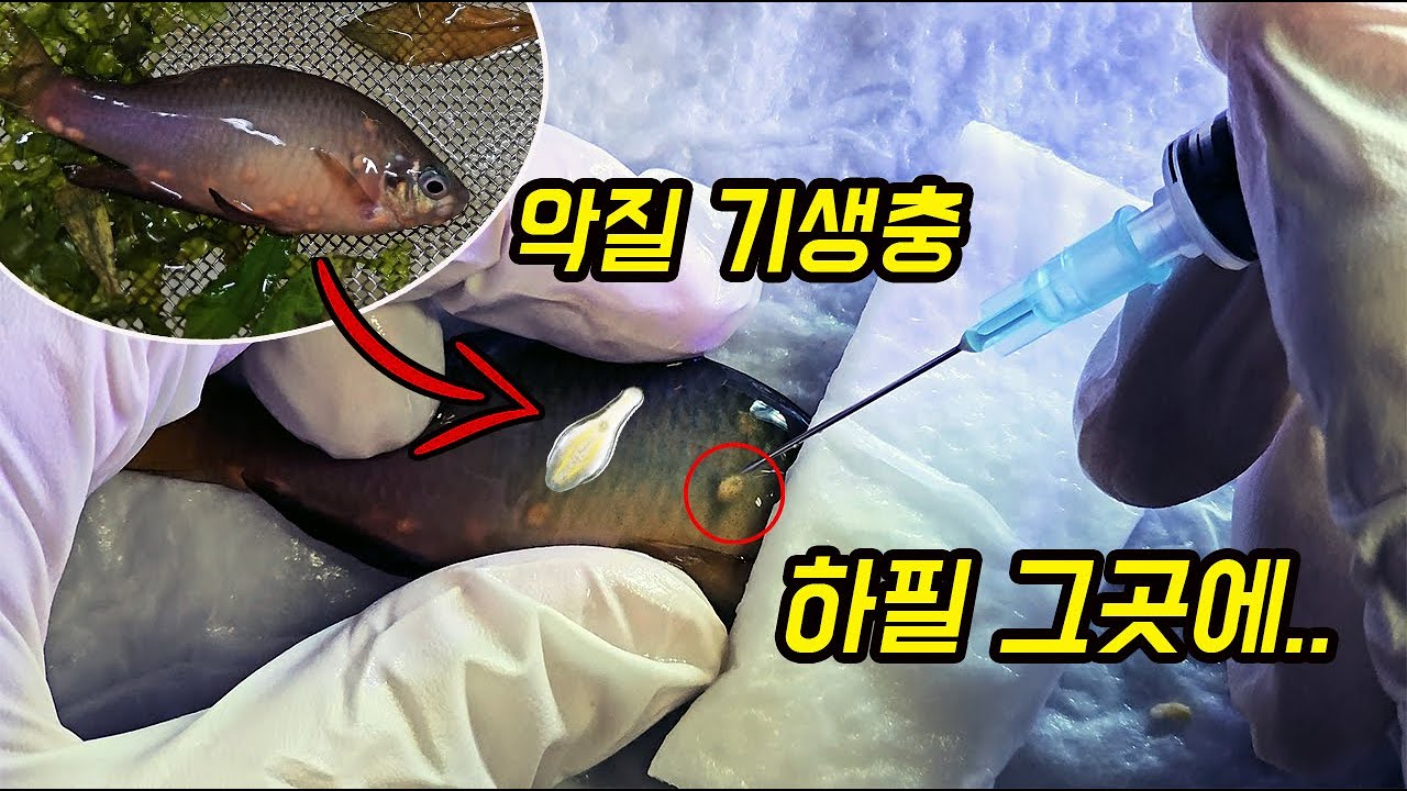 민물고기를 파 먹고 살아가는 기생충 수십 마리가 위험한 곳에 자리 잡았네요 정교한 제거가 필요합니다 [오브리더]