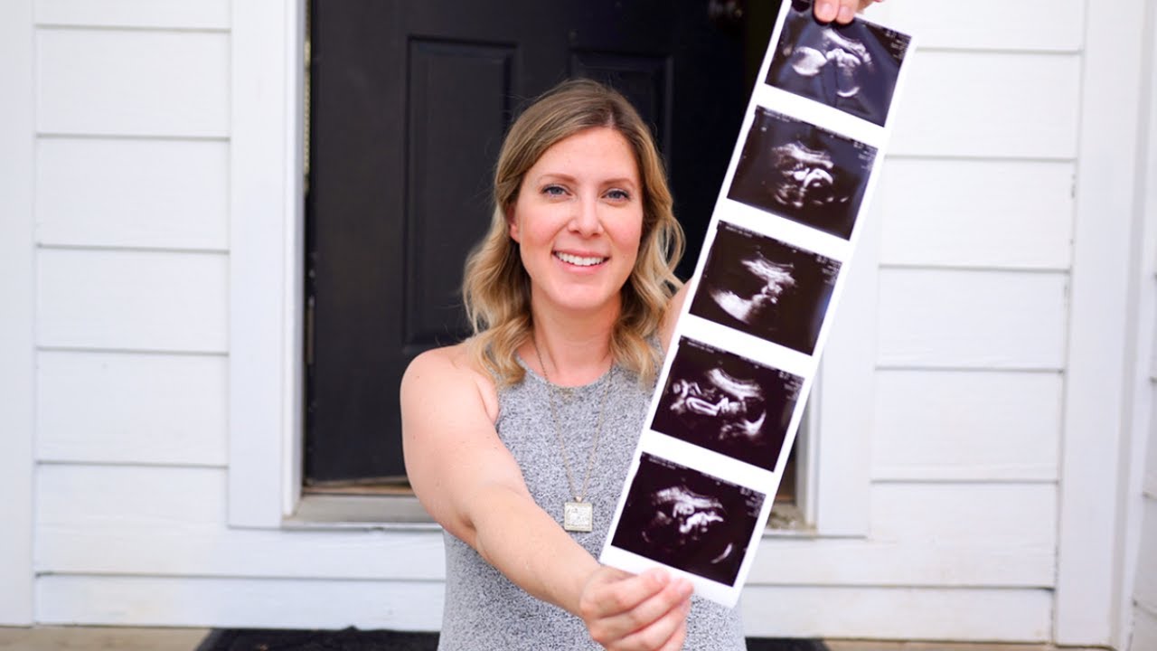 25-30 WEEK BUMPDATE | Congenital Heart Defect (CHD)
