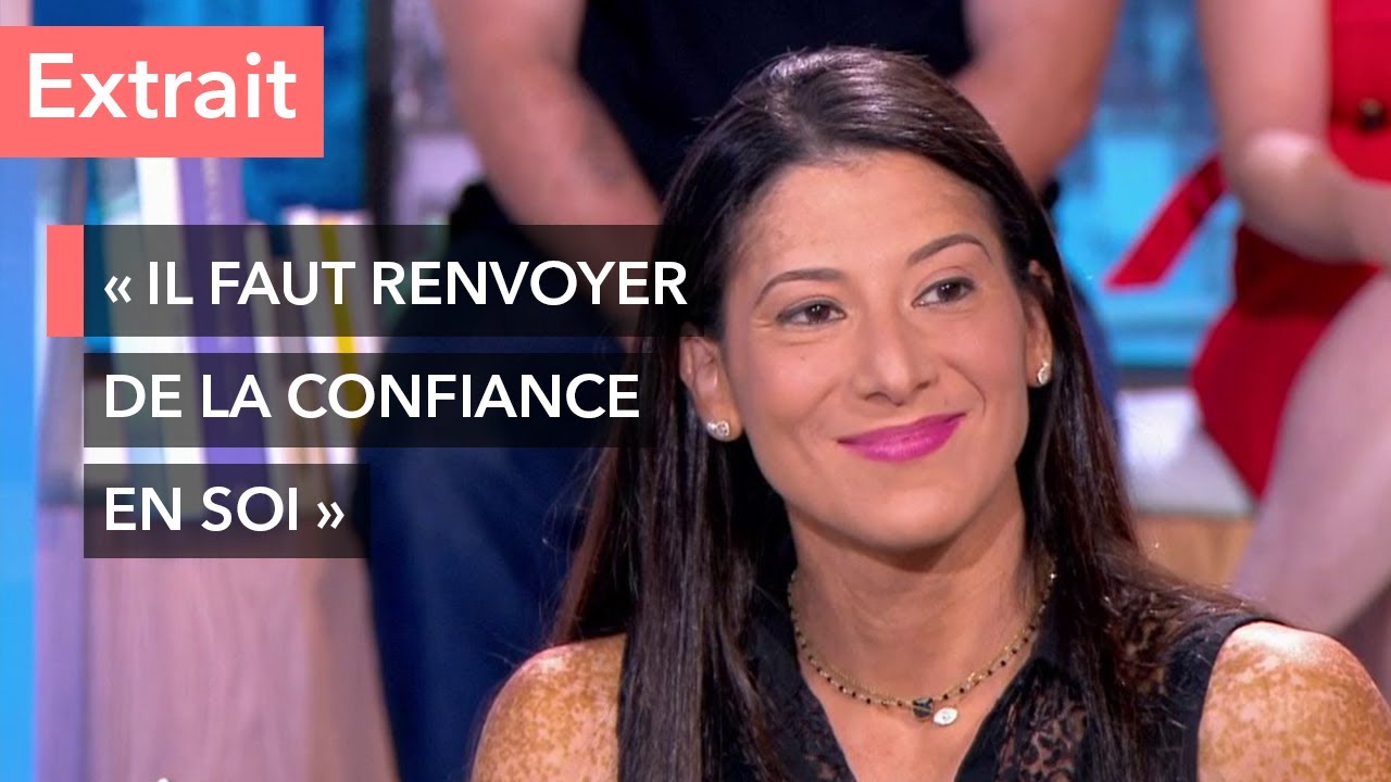 Elle a le corps recouvert à 100% de vitiligo - Ça commence aujourd'hui