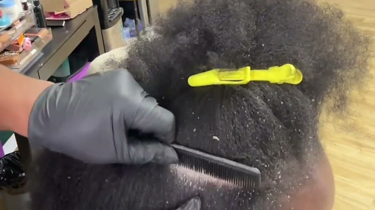 Huge flake removal ASMR