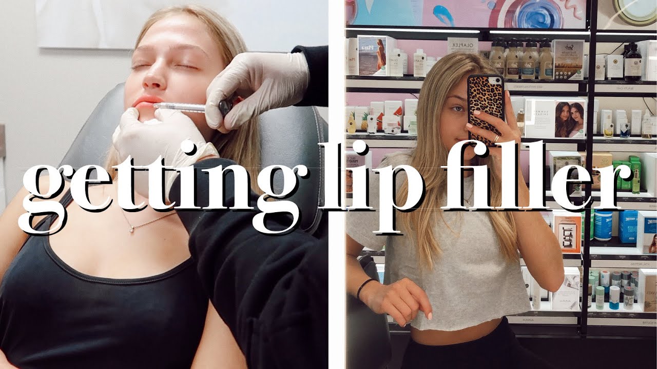 vlog: getting lip filler, sephora facials, & mini mall haul | maddie cidlik
