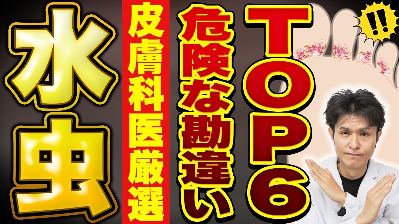 水虫これダメ絶対6選｜原因・検査・市販薬・内服/外用の選び方まで完全解説！