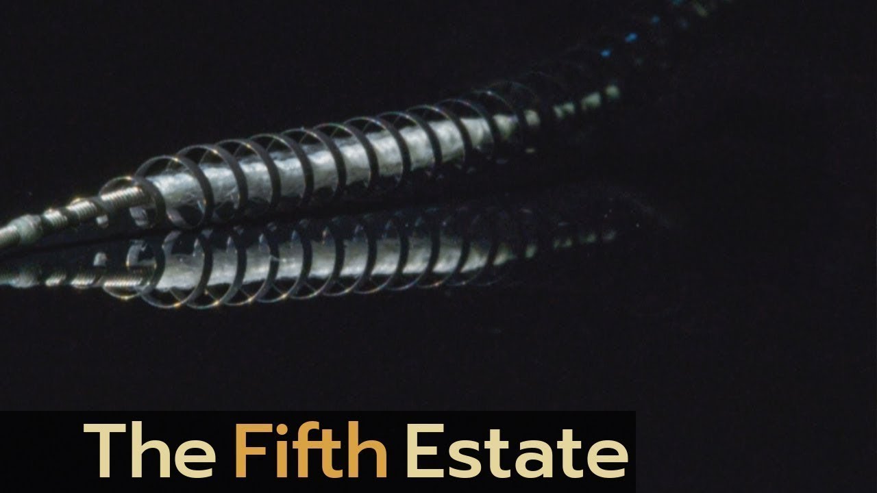 Unreported: The Essure Story | Implant Files
