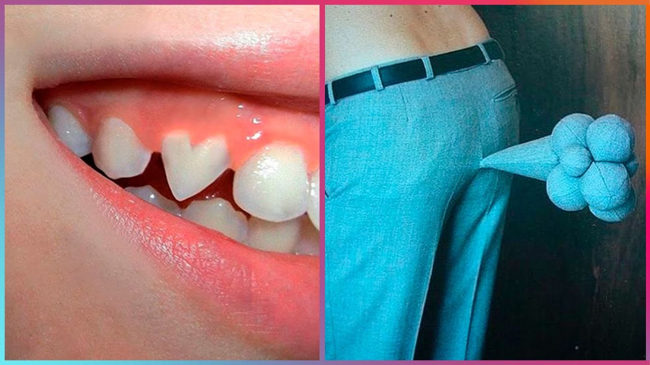 Самые Забавные Артисты В Мире ▶12