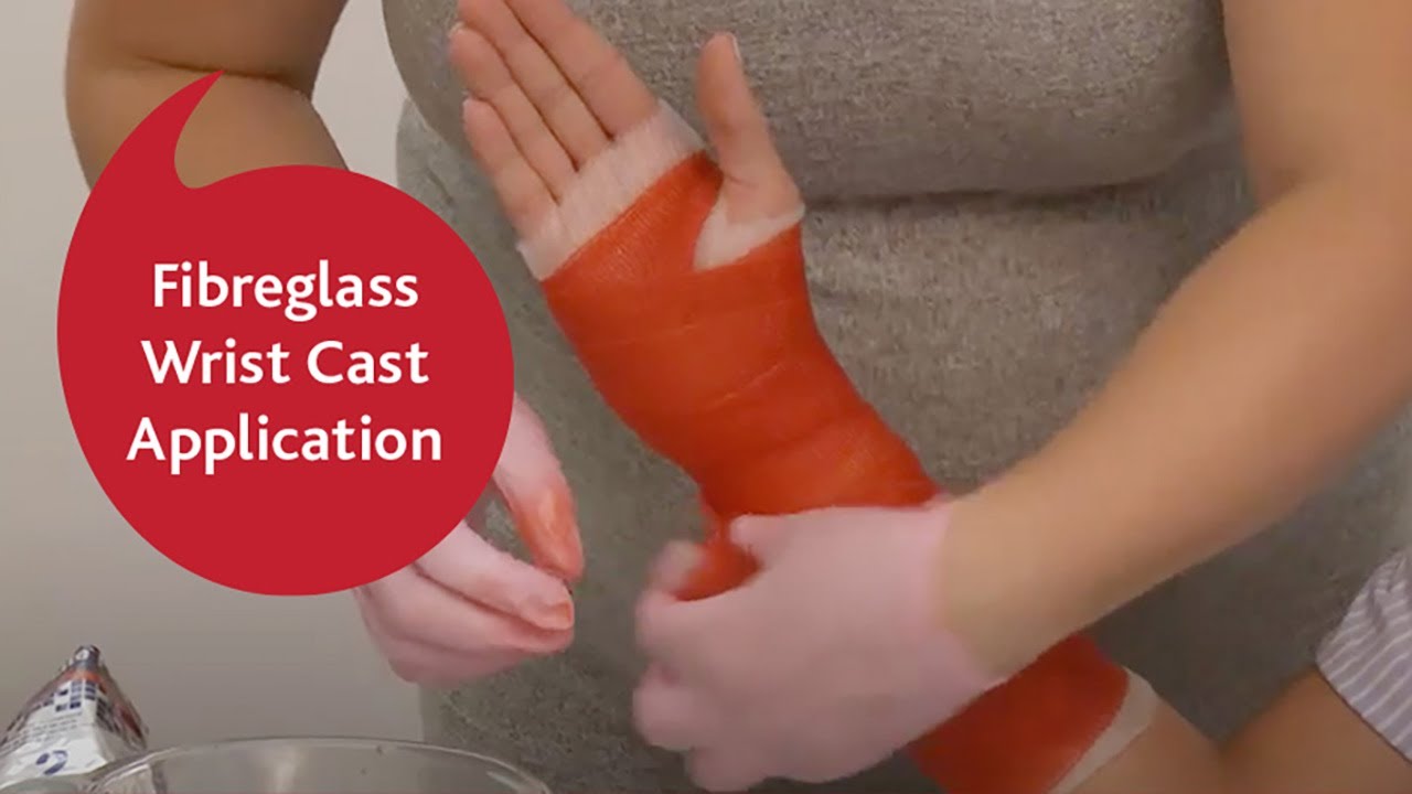 Fibreglass Wrist Cast Application