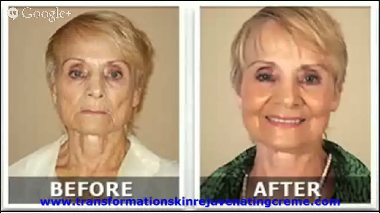 Anti Wrinkle Cream Reviews Lifecell All In One Anti Wrinkle Cream