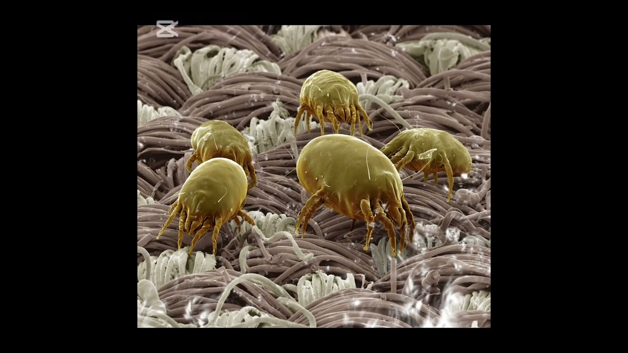 House 🏠 Dust Mites 