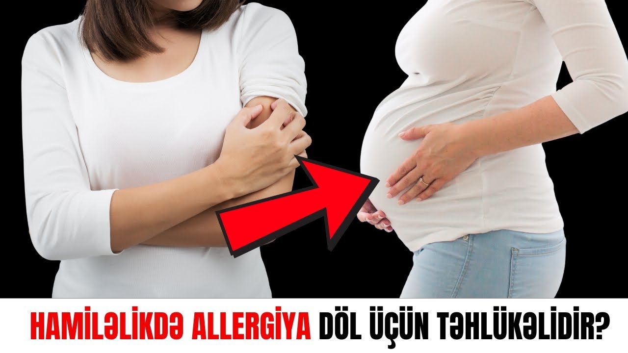 Hamiləlik və allergiya