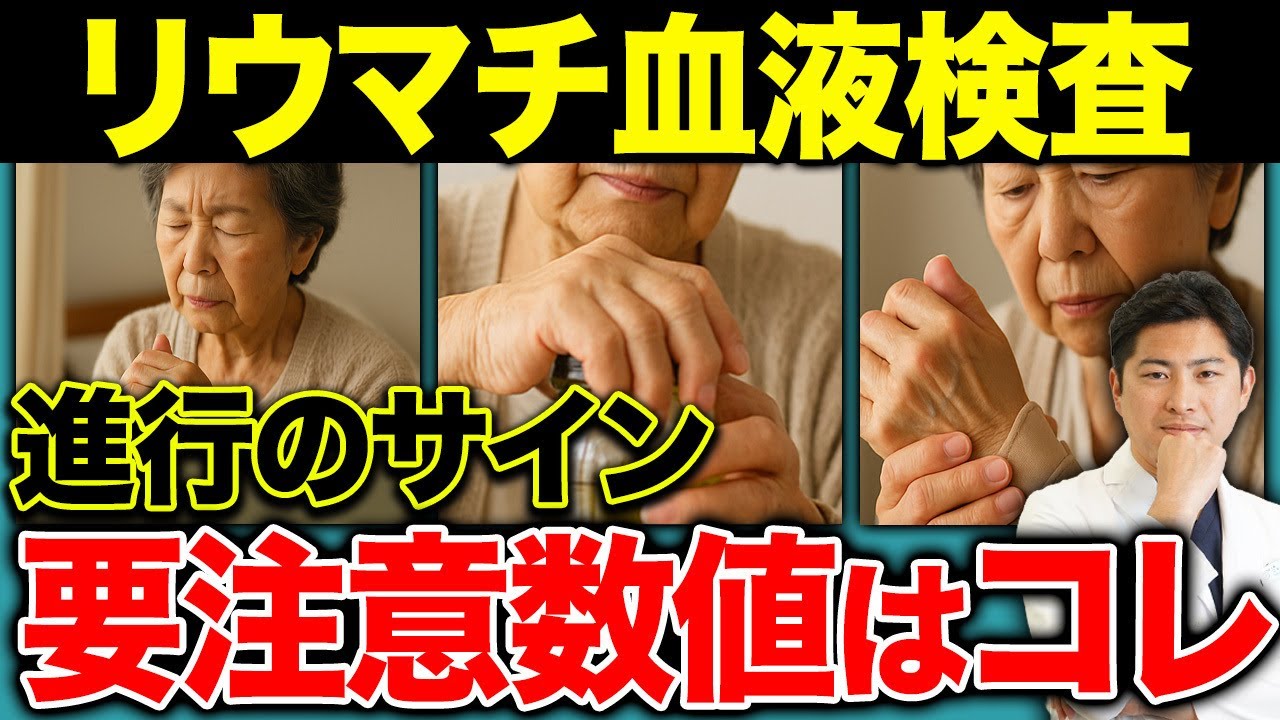 【早期発見の鍵】リウマチ進行リスクがわかる「抗CCP抗体」とは？検査で変わる治療戦略【関節リウマチ/抗CCP抗体/進行予測】