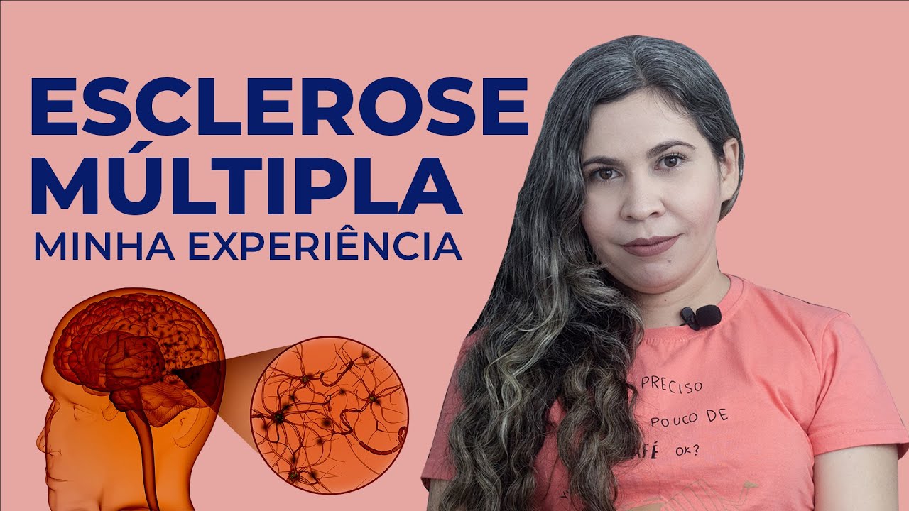 Minha experiência com a Esclerose Múltipla | Joseane Santos