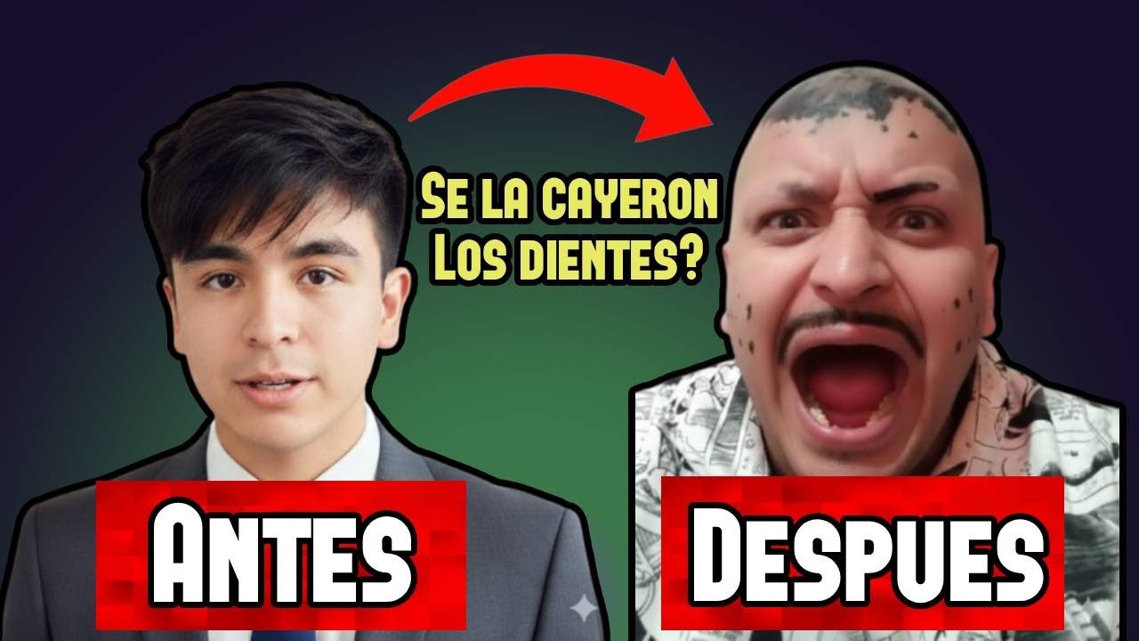El CAMBIO FISICO de KBEZUKO l Donde quedaron sus dientes?