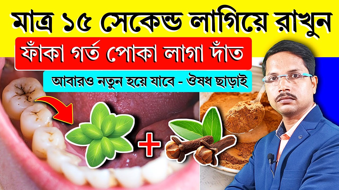 মাত্র ১৫ সেকেন্ড লাগিয়ে রাখুন - গর্ত ফাঁকা পোকা লাগা দাঁত নতুন হয়ে যাবে | দাঁতের সমস্যার সমাধান |