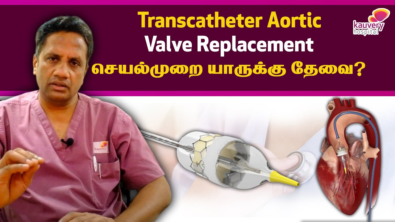 Who needs the Transcatheter Aortic Valve Replacement (TAVR)  procedure? ( Tamil )