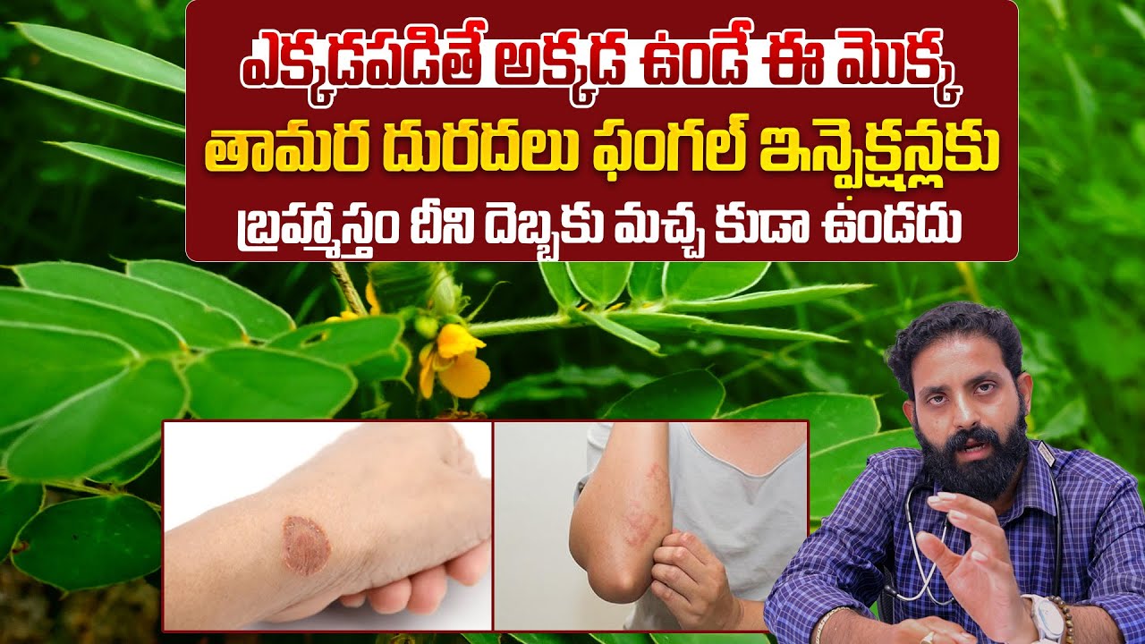 ఈ మొక్క తామర కు బ్రహ్మాస్తం దీని దెబ్బకు మచ్చ కుడా ఉండదు | “Powerful Herbal Plant for Ringworm