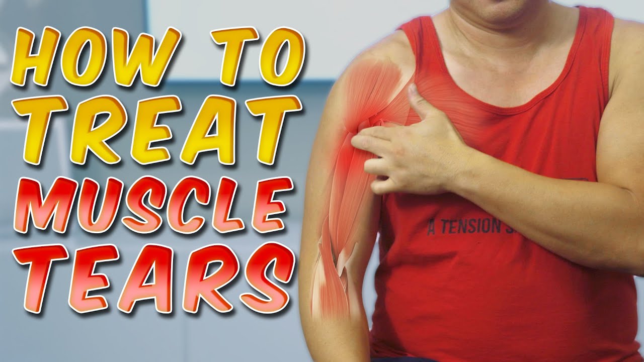 Muscle Tears: Massaging and Taping | Physical Therapist Teaches