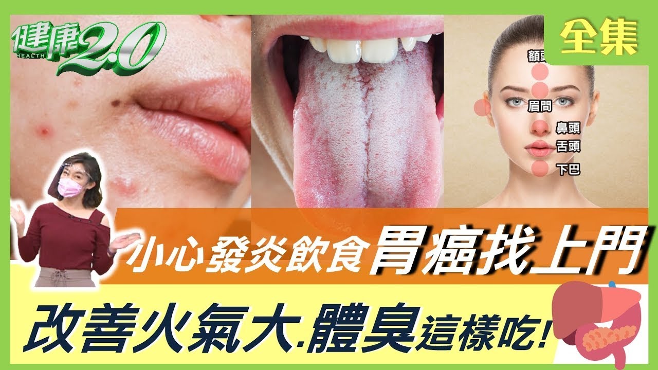 愛吃發炎飲食胃癌找上門！12%早死活不過70歲！ 耳冒青筋血絲是警訊！ 想滅身體的火 體臭這樣吃！【健康2.0精選】
