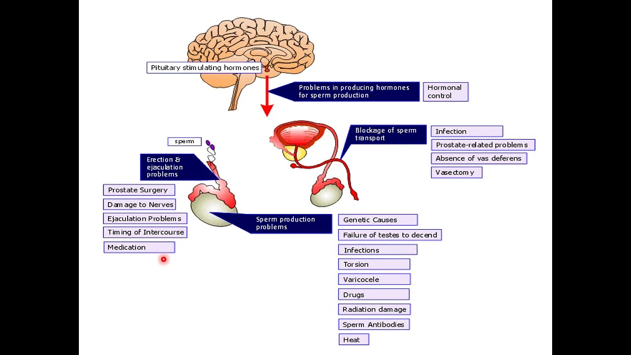 03 Male Infertility 1st Part