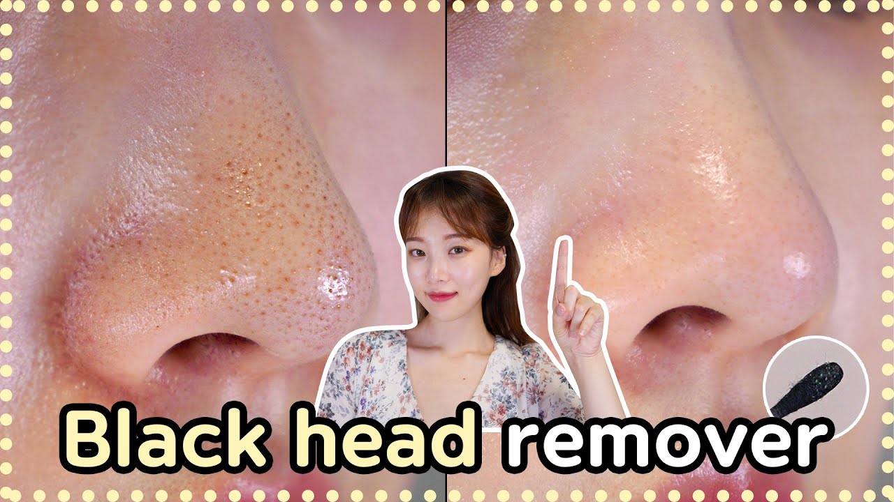 Is it possible to get rid of blackheads at home? Black head remover 👃🏻 #How to improve your skin