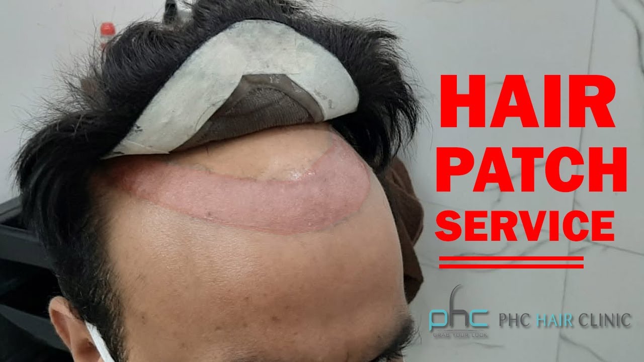 Hair Wigs Service in Delhi | Hair Patch in Delhi Call 9899746489