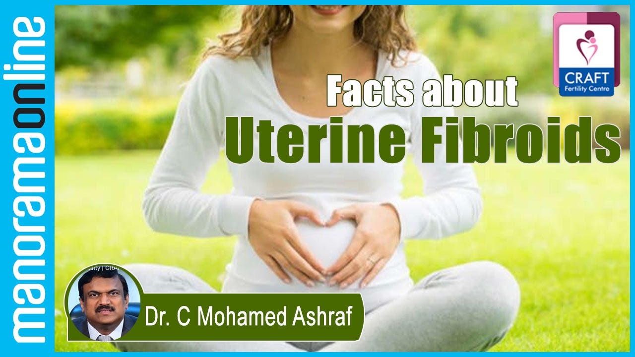 Facts about Uterine Fibroids | Dr. C Mohamed Ashraf | CRAFT Fertility Centres | Manorama Online