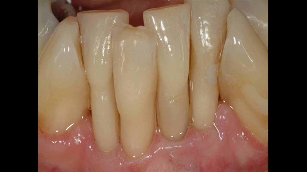 V1 Wellness Dentistry   The Dentists Role in Whole Body Health